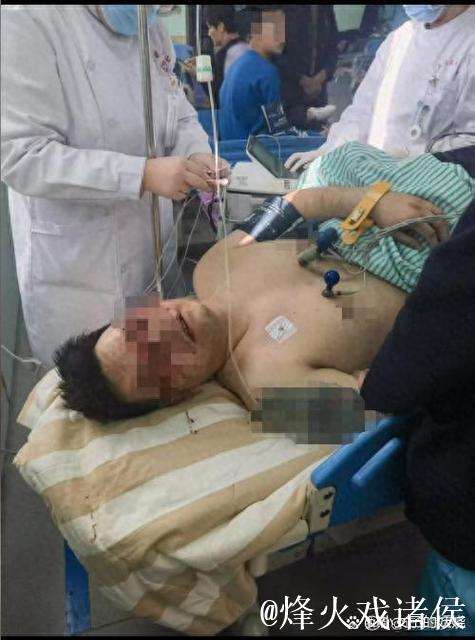 徐杰伤后返回基地视频曝光！左眼贴纱布无大碍！