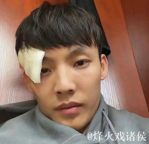 徐杰伤后返回基地视频曝光！左眼贴纱布无大碍！